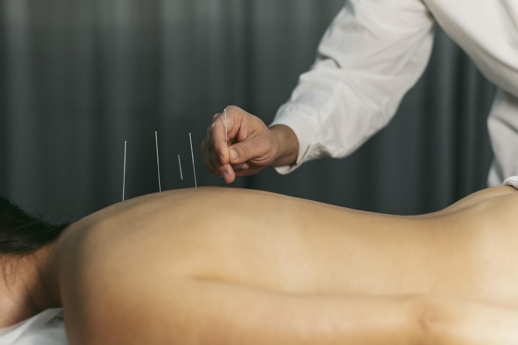Acupuncturist in Arnhem