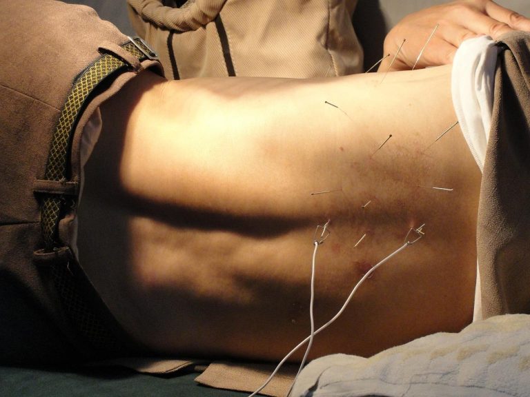 Acupuncturist in Arnhem