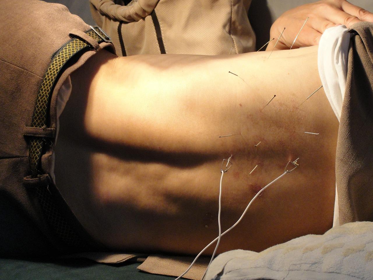 Acupuncturist in Arnhem