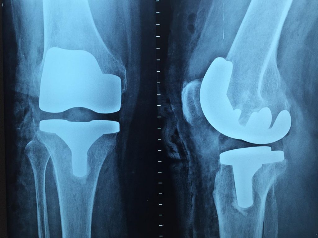 Orthopedie in Arnhem